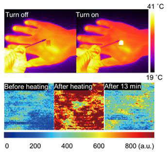 IBS 연구팀이 개발한 '투명 온열패치'를 실제 손가락에 붙여 혈류량이 증가해 여드름과 염증 등을 치료할 수 있다.  IBS 제공